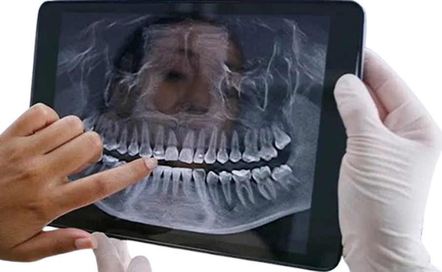 Dental X-ray on tablet