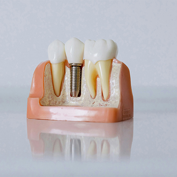 Emergency Dentistry