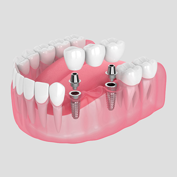 Emergency Dentistry